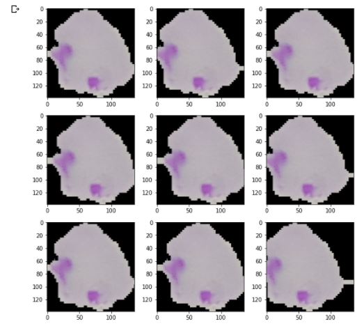 ML Project 1: Cell Malaria | Ravide’s Machine Learning Portfolio